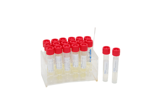 virus eliminabile 2mL che prova la provetta di Kit Medical VTM con il bastone del tampone della gola