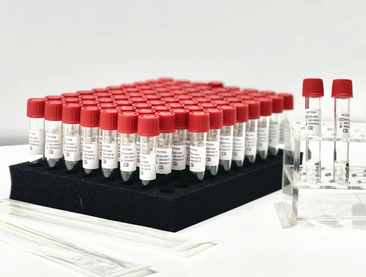 Un'estrazione Kit From paziente Pharynx Swab di PCR del reagente del rilascio del campione di punto