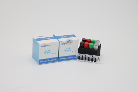Corredi diagnostici in tempo reale clinici in tempo reale di PCR del corredo POCT IVD di PCR di HIV di alta precisione