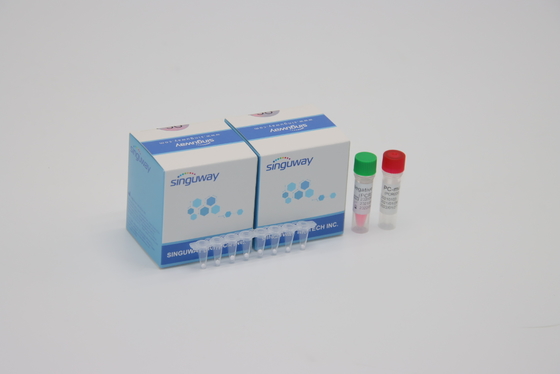 CE fluorescente quantitativo di tempo reale del corredo POCT di rilevazione di PCR del virus di HIV