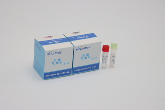 Corredo fluorescente quantitativo IVD di rilevazione di PCR per tutta la Corona Virus Mutations