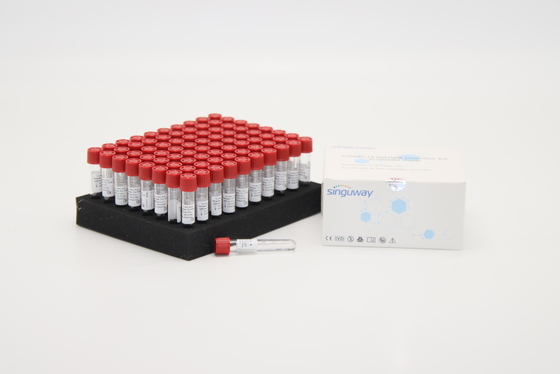 80 prove altamente sensibili 1 PCR acida nucleica di Kit For dell'estrazione di punto